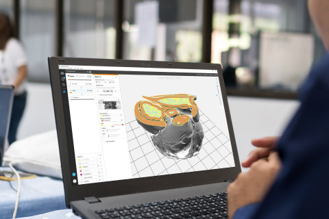Stratasys Advances Personalized Healthcare With New Innovations in Software for 3D Printed Anatomic Models
